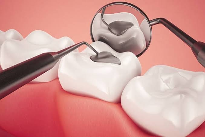 Restorative dental treatment