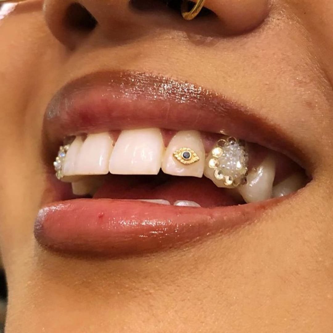 Professional tooth jewellery placement