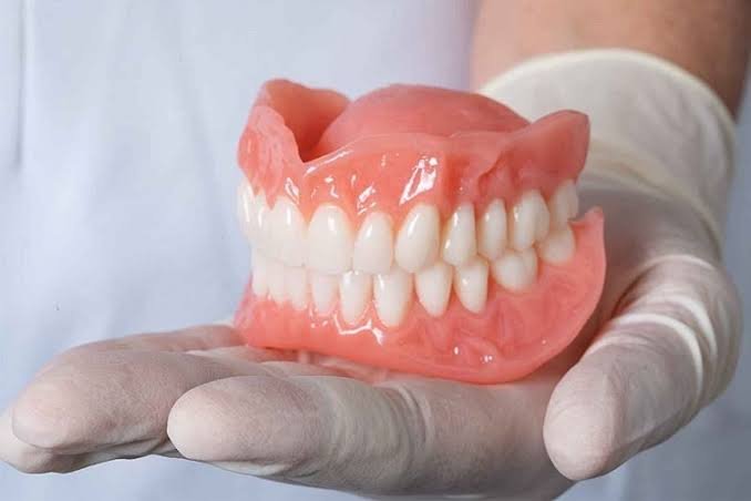 Complete denture treatment at Pristine Dental Raipur