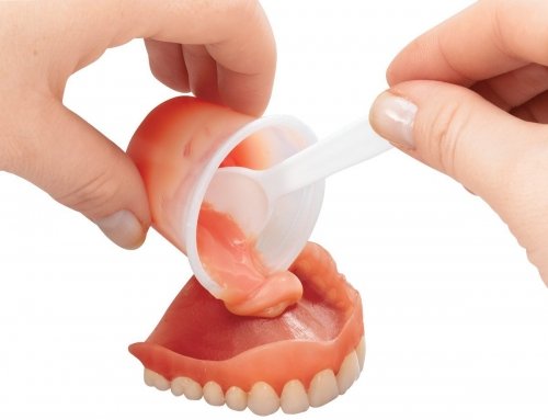 Denture relining and rebasing at Pristine Dental Raipur