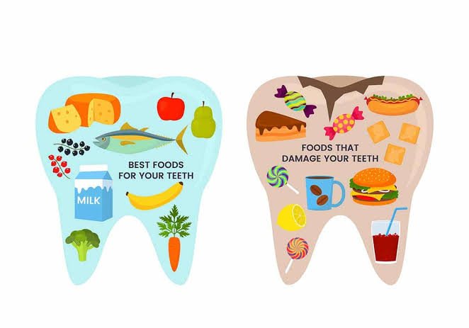 Diet counselling for cavity prevention