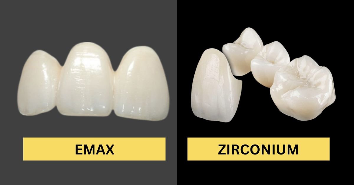 E.max and zirconia crowns