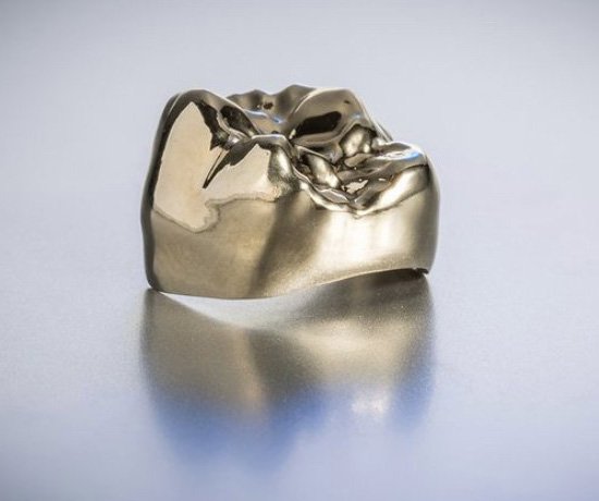 Full-metal dental crown