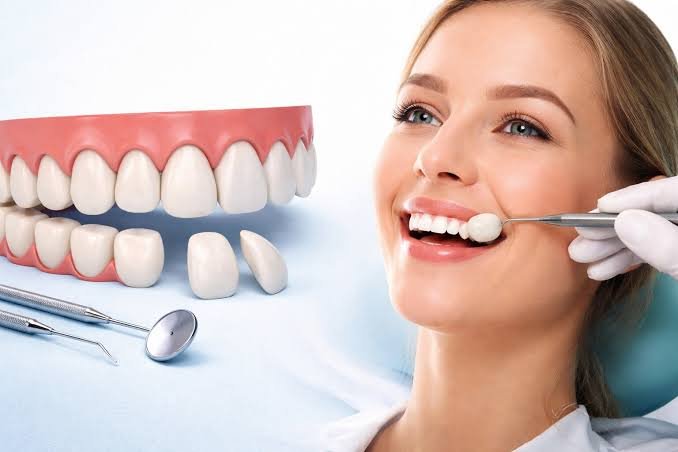 Laminate dental veneers
