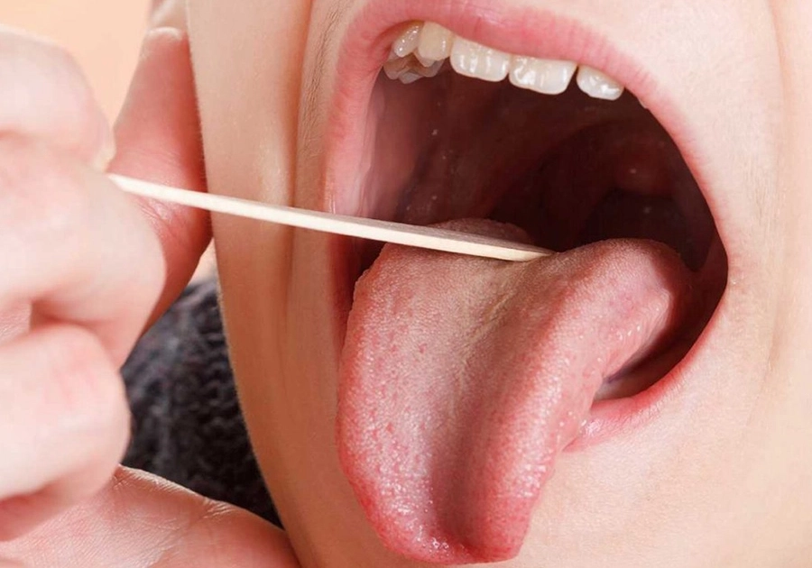 Oral mucosal disease examination and treatment