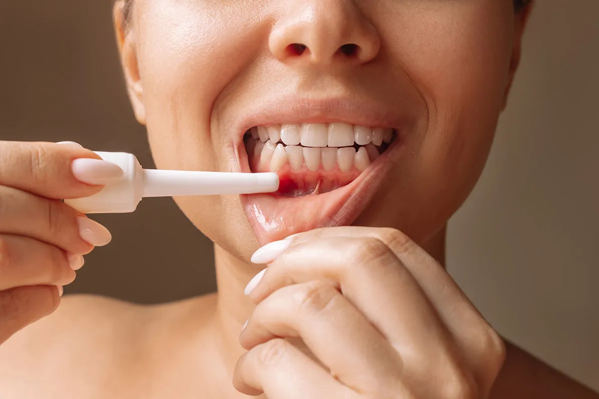 Oral mucosal disease evaluation and treatment