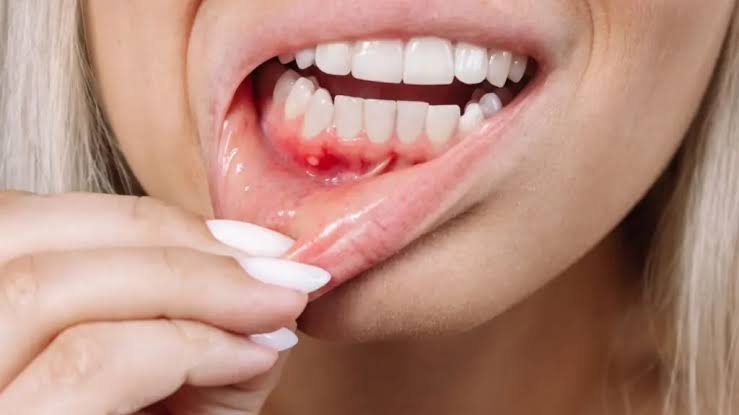 Periodontal disease and factors affecting gum health