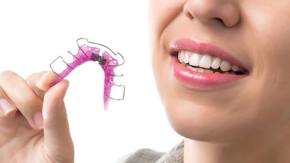 Removable orthodontic appliances