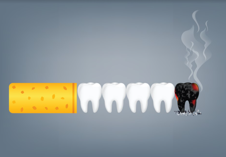 Smoking cessation counselling