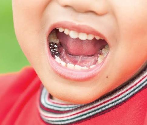 Stainless-steel crown for a primary tooth