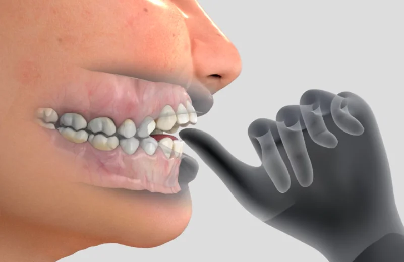 Thumb sucking and night grinding counselling