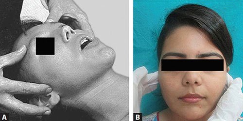 TMJ disorder evaluation and management