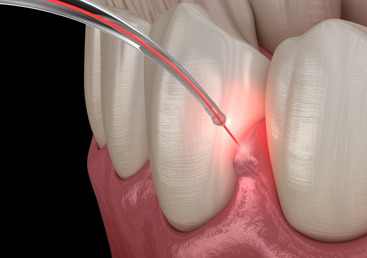 Specialist periodontal and gum care