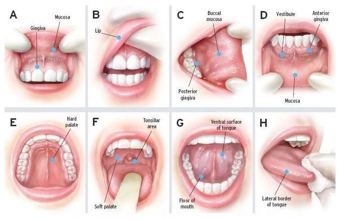 Oral lesion evaluation and biopsy