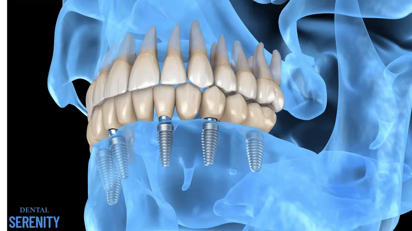 Dental implant consultation and treatment